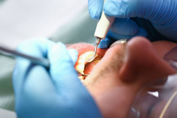 Best Weekend Emergency Dentist in Salinas, CA