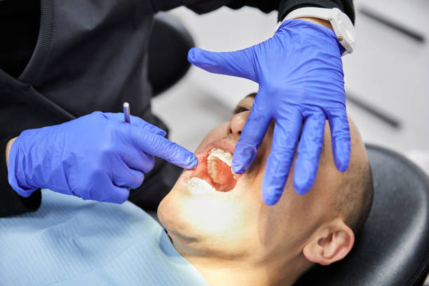 Best Emergency Tooth Extraction in Salinas, CA